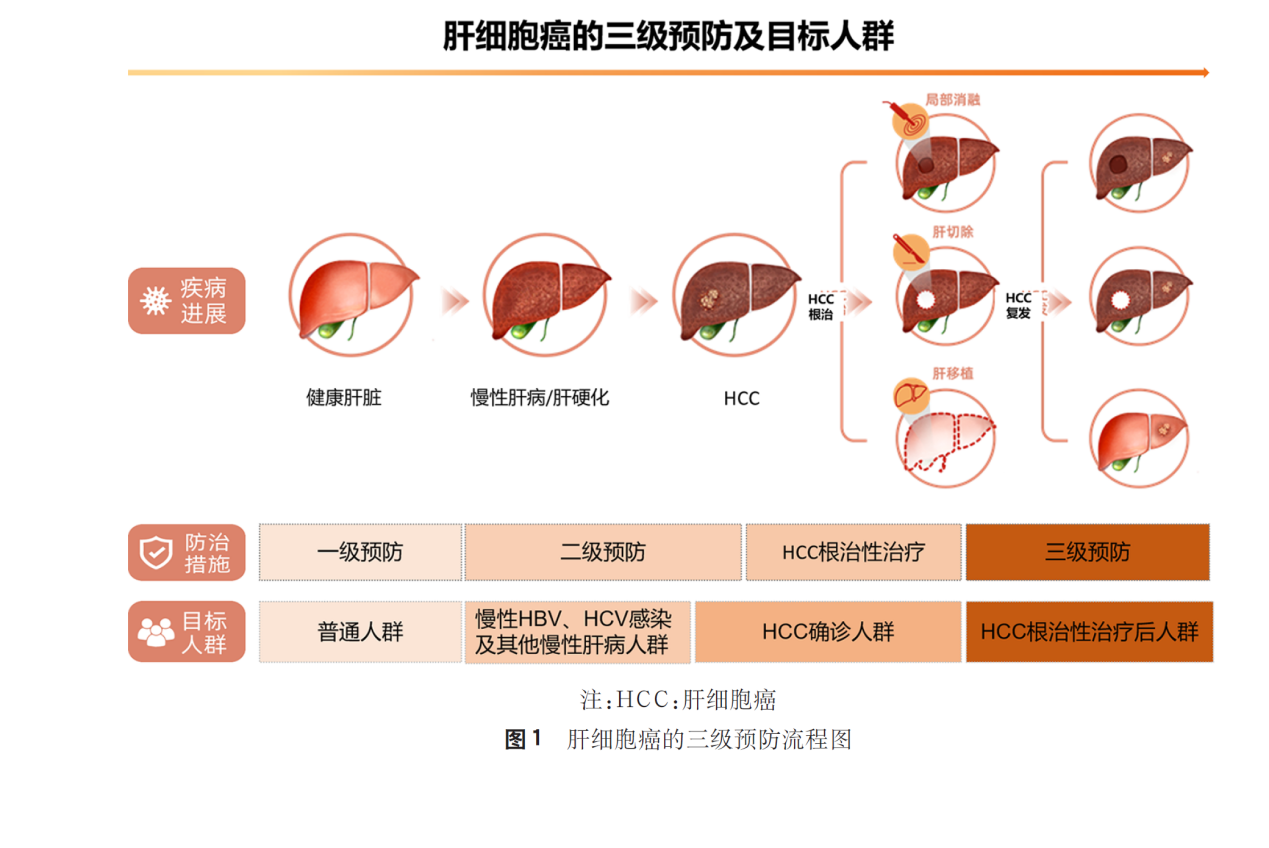 原發性肝癌三級預防共識（2022年版）指出復方鱉甲軟肝片有助于降低肝癌復發風險