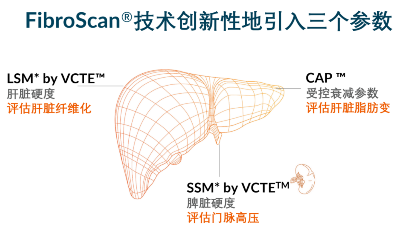 喜訊！FDA擴大了FibroScan?在肝臟綜合管理中的應用范圍