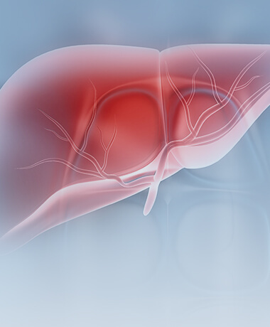 肝癌高風險人群解決方案